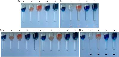 Prenatal diagnosis of fetomaternal hemorrhage by a novel hydrogel fluoroimmunoassay that accurately quantifies fetal haemoglobin